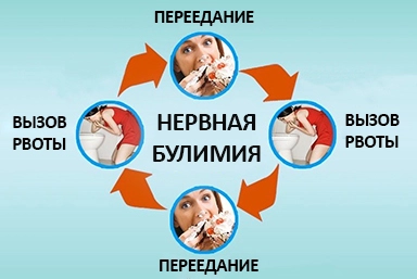 Лечение булимии в Кушве